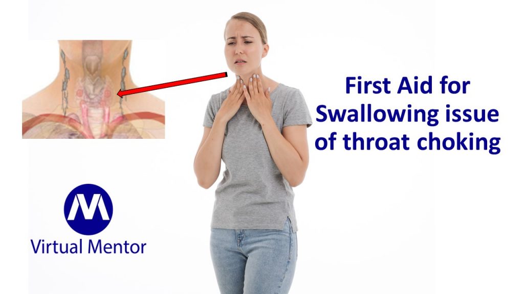 First Aid for Swallowing issue of throat choking Virtual Mentor