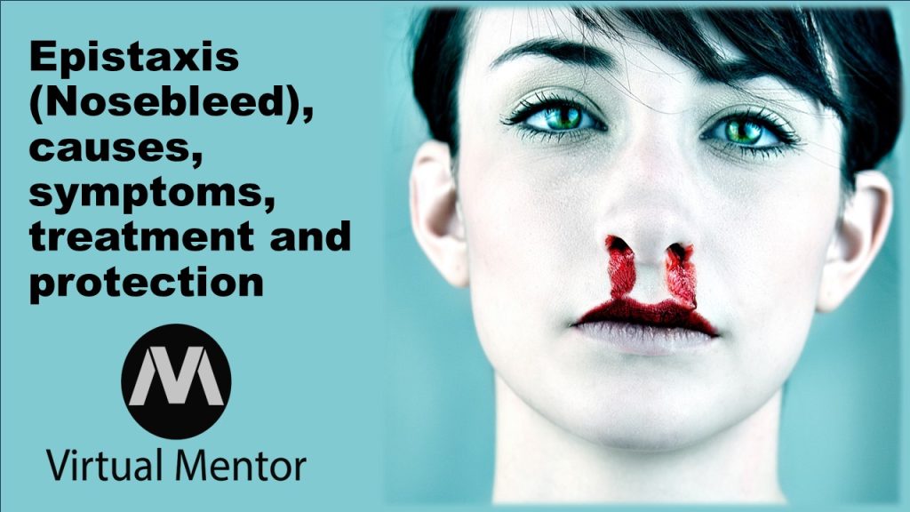 Epistaxis (Nosebleed)-causes, symptoms-treatment-&-protection